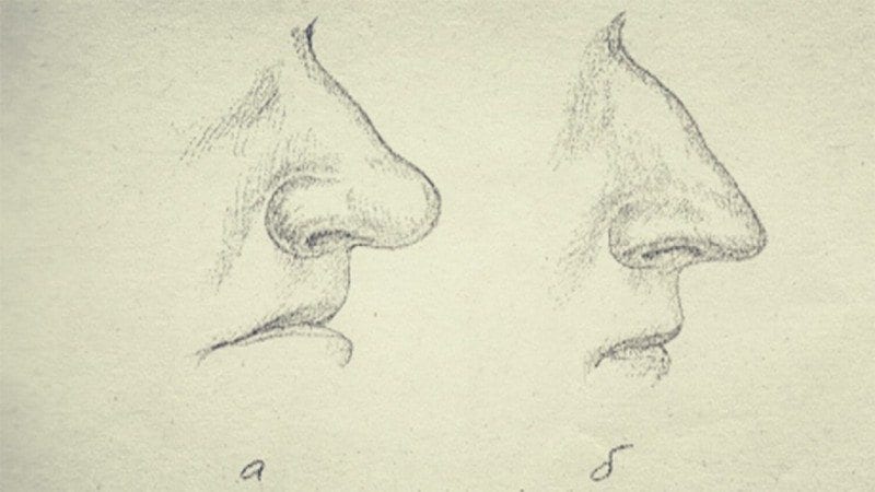 Рис.14. Форма кончика носа: а – округлая; б - заостренная.