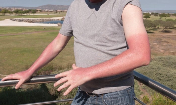 Солнечные ожоги сделают мучительными даже самые лёгкие действия. В то время как крем может стереться или смыться, солнцезащитная одежда никуда не денется!